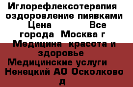 Иглорефлексотерапия, оздоровление пиявками › Цена ­ 3 000 - Все города, Москва г. Медицина, красота и здоровье » Медицинские услуги   . Ненецкий АО,Осколково д.